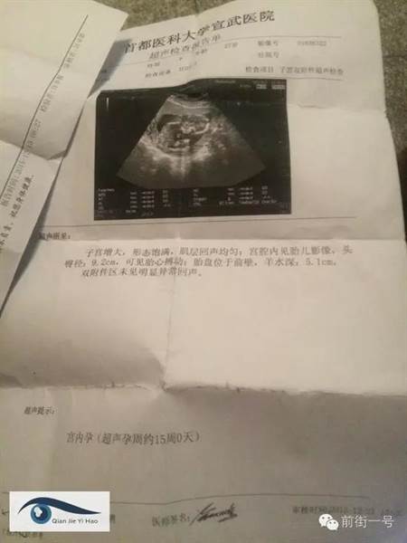 20160316006761.jpg