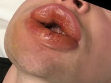 2.jpeg 2.jpeg